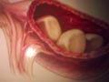 Batu Ginjal Pada Anjing (Urolithiasis)
